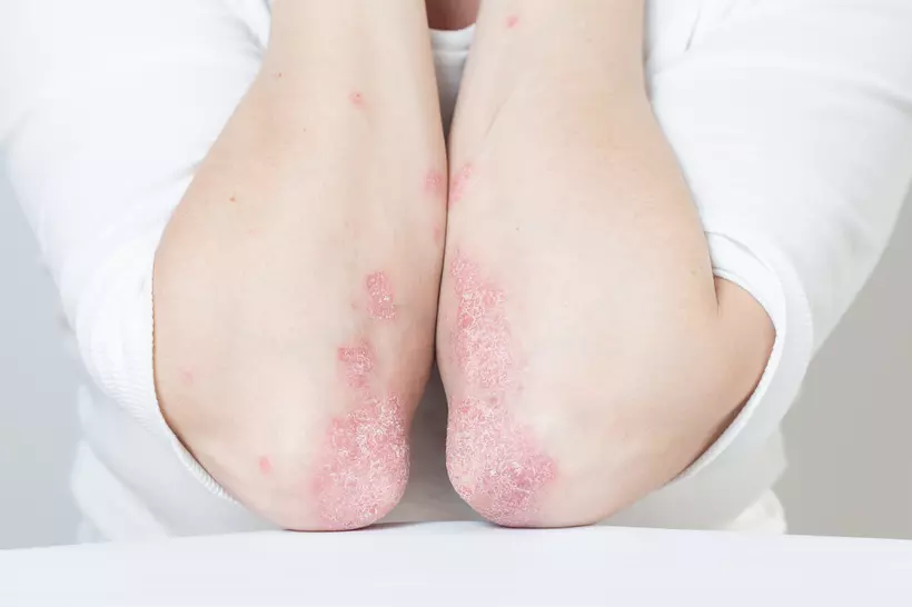 Tout savoir sur la peau et les maladies dermatologiques